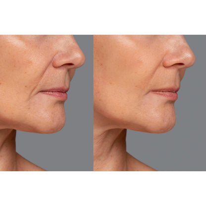 LED Light Therapy Face Mask