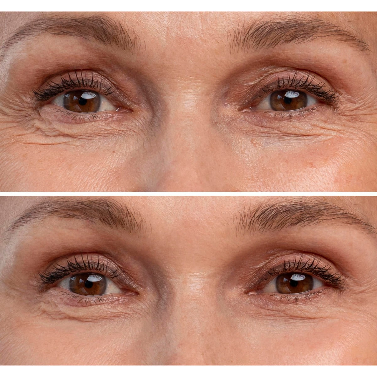 LED Light Therapy Face Mask